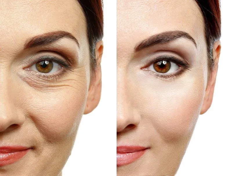Beauty age cream lékárna, cena, kde koupit levné, co to je, kde objednat, Česko, recenze.