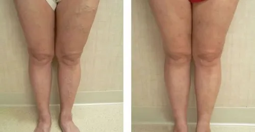 Wintex ultra gel : složení pouze přírodní složky.